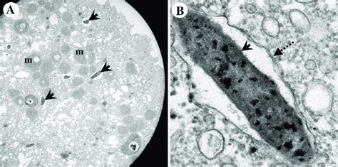 Morphological Appearance Of Endocytobiont Endoimu7 Inside Acanthamoeba Download Scientific