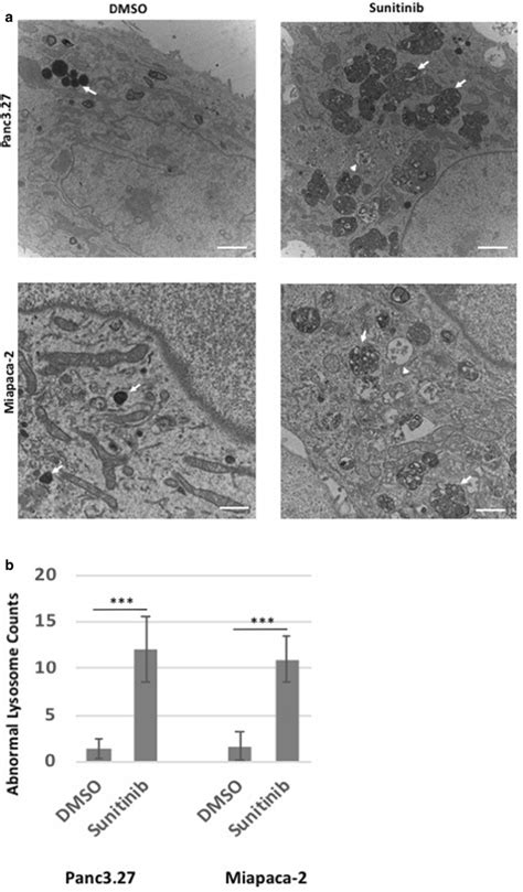 Ultrastructural Pathology Of Sunitinib Treated Human Pdac Cells