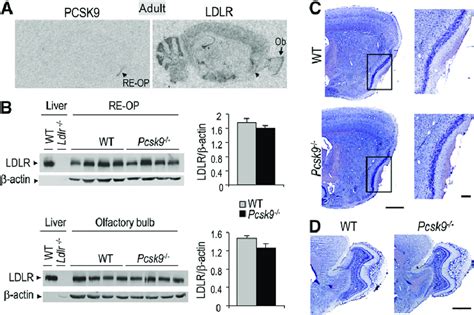 LDLR Regulation By PCSK9 At Adulthood A In Situ Hybridization Of