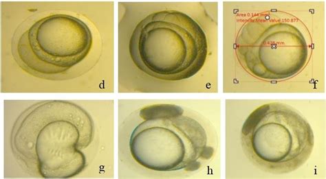 Unfertilized And Fertilized Eggs With Developmental Stages Up To