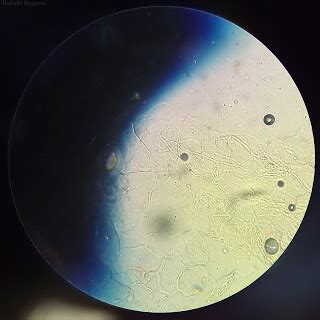 MICROCOSM: Нити мицелия, ногти стоп.