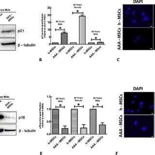 A Representative Western Blot Images Showing P21 CIP1 Expression In H