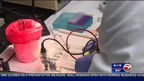 University of Miami working to develop vaccine - WSVN 7News | Miami News, Weather, Sports | Fort ...