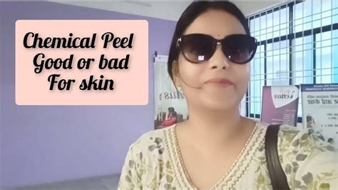 My Chemical Peel Experience Do S Don Ts Kab Or Kaha Karwaaye All