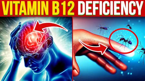 12 Vitamin B12 Deficiency Symptoms That You Should Never Ignore