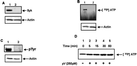 Expression And Autophosphorylation Of Syk In Breast Cancer Cells A