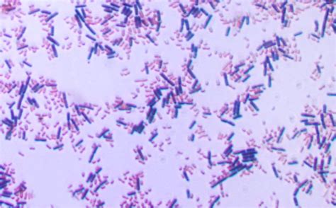 The Starting Culture Is A Mixed Population Of Both Gram Positive Blue