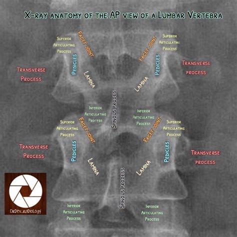 Pin By Max On Rg Radiology Student Medical Radiography Radiology