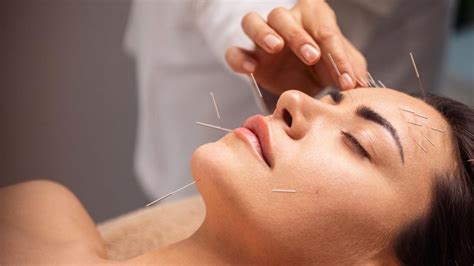 Acupuntura Facial Cu Les Son Sus Beneficios Hogarmania