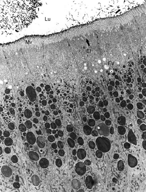 Transmission Electron Micrograph Tem Of The Epithelium In The