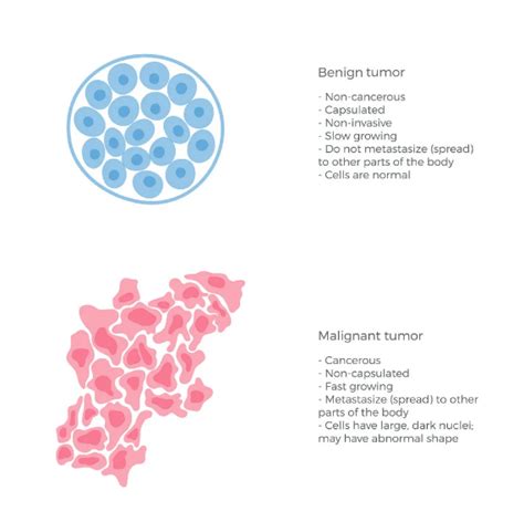 Benign Vs Malignant Cells