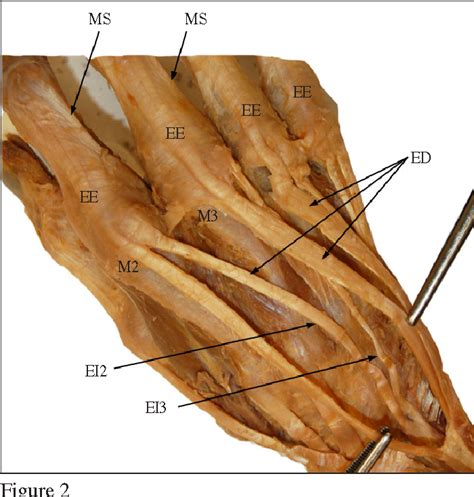 Extensor Indicis Cadaver