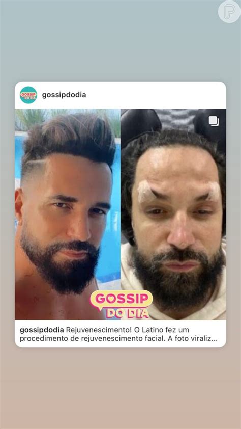 Foto O Antes E Depois De Latino Chocou A Web Purepeople