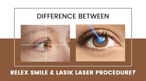 Difference Between Relex Smile Lasik Laser Procedure Dlei