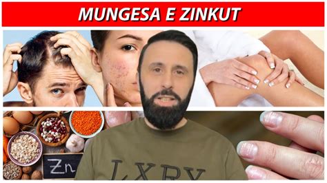 Askush Nuk Ju Ka Th N Deri M Sot Q Mungesa E Zinkut Sjell Gjith