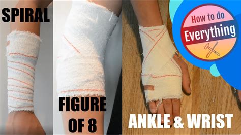 HOW TO APPLY BANDAGE 3 Basic Methods YouTube