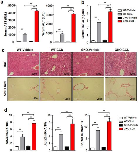 Gdf Deficiency Exacerbates Ccl Induced Liver Fibrosis A Serum