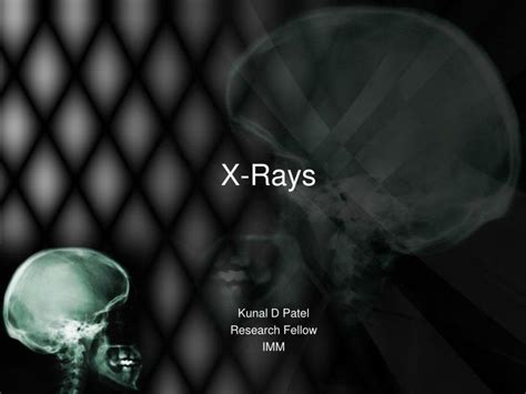 Ppt X Rays Powerpoint Presentation Free Download Id3333758