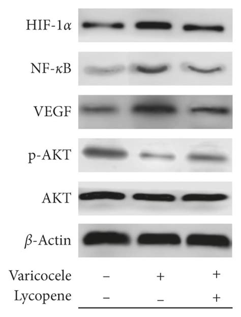 A Representative Blot Results Of Hif 1α Nf κb Vegf Pakt And Akt