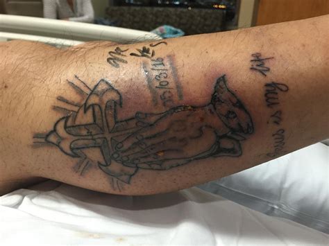 Man Dies After Flesh Eating Bacteria Infects New Tattoo Cbs News