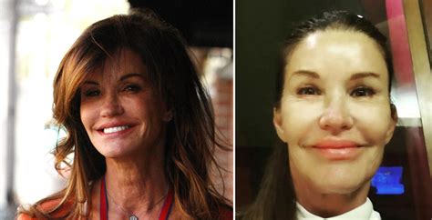 Janice Dickinson Then And Now