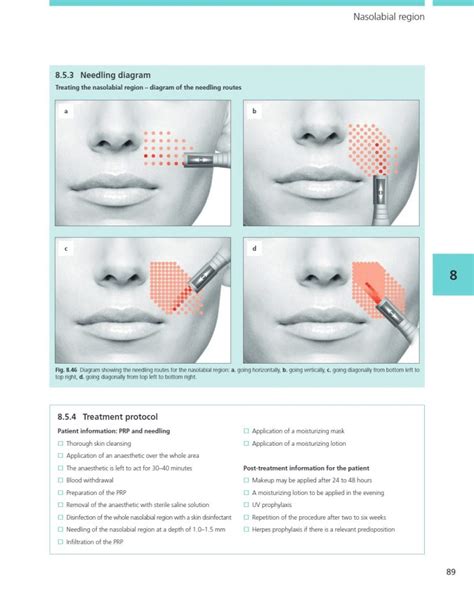 Illustrated Guide To Collagen Induction With Platelet Rich Plasma Prp