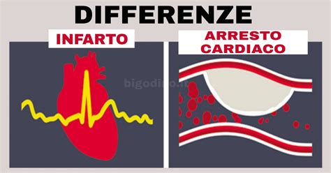 Differenze Tra Infarto E Arresto Cardiaco