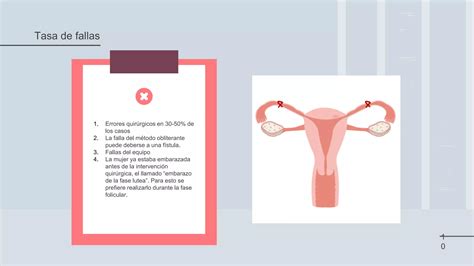 Esterilizaci N Quir Rgica Femenina By S Crates Pozo Ppt