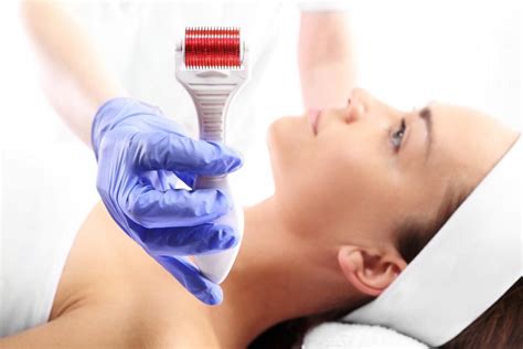 Heres How Microneedling Can Help Turn Back The Clock On Your Skin