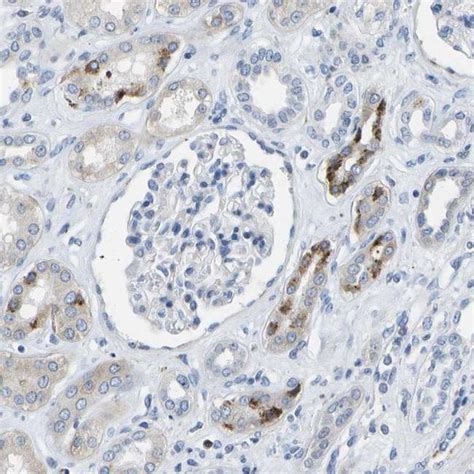 NOX4 Antibody