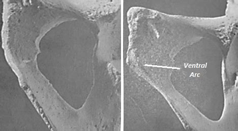 Estimate The Biological Sex Of A Human Skeleton All Things AAFS