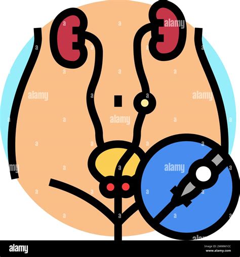 Ureteroscopy Urology Color Icon Vector Illustration Stock Vector Image