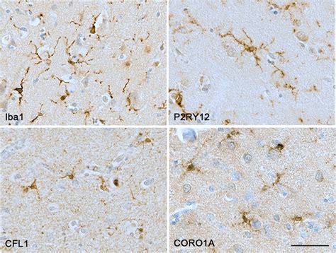 Illustration Of The Immunostaining Obtained With The Different