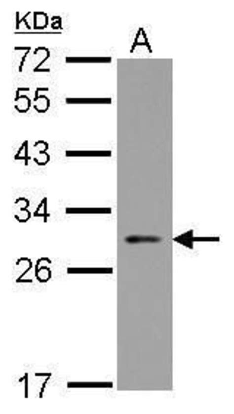 Arc Polyclonal Antibody Invitrogen 100 μl Unconjugatedantibodies