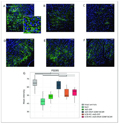 Immunoexpression Of PSD95 In The Rat Brain Cortex 21 Days After The