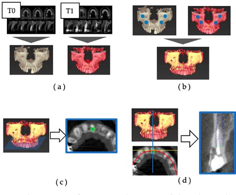 Figure From Pre And Postoperative Evaluation Of Immediate And Early