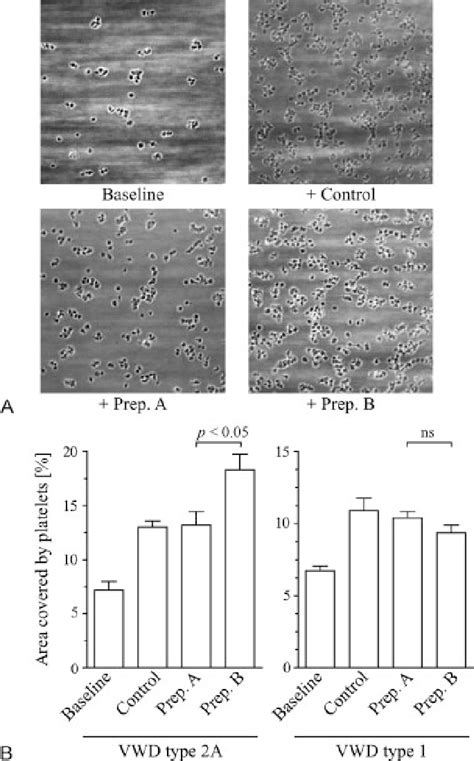 Effect Of Vwf Preparations On Platelet Adhesion Added To Blood From Vwd