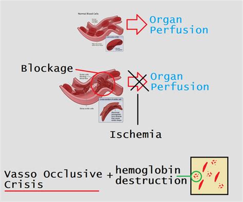 Ch 34 Coordinating Care For Patients With Hematological Disorders