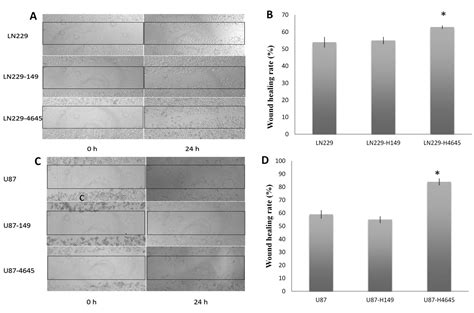 Moesin Expression Is Associated With Glioblastoma Cell Proliferation