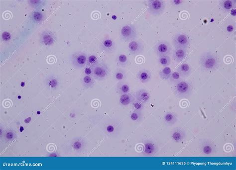 Chromosomes Human Under the Microscope for Education. Stock Image - Image of karyotype ...