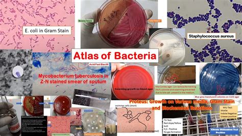 Atlas Of Bacteria Introduction And List Of Bacteria And Related Features