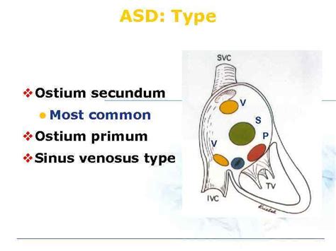 Congenital Heart Disease Adult Chd Is Not