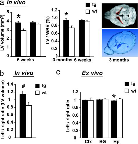 Dominant Negative Disc1 Transgenic Mice Display Schizophrenia