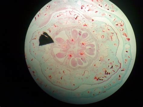 Hibiscus Rosa Sinensis Gumamela Ovary Cross Section Lpo A Photo On