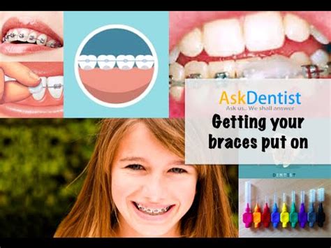 How to Take Care of Your Braces and Get 11 Braces Care Tips Now | How to Whiten Your Teeth