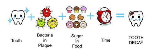 Dental Caries (Tooth Decay) – prestige-dental-care.com.my