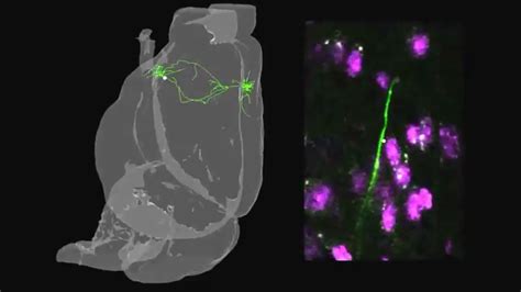 A Platform For Brain Wide Imaging And Reconstruction Of Individual