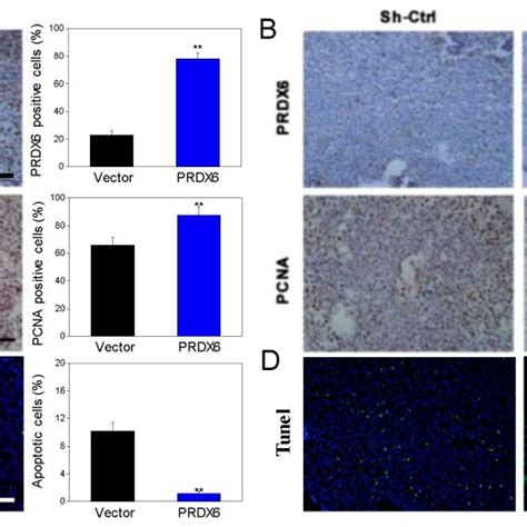 The Expression Levels Of PRDX6 And PCNA As Well As TUNEL Positive