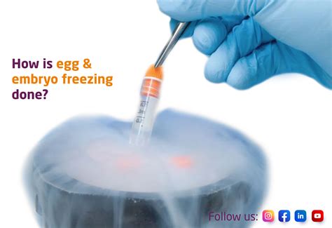 How Is Egg And Embryo Freezing Done