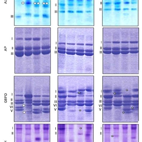 Isoenzymes electrophoresis of alkaline and acid phosphatase ...